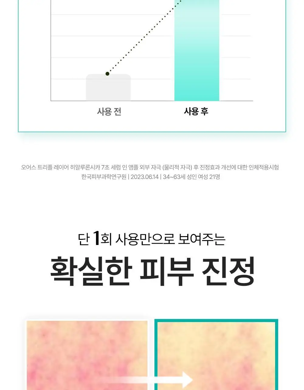 [히알속수분세럼 / 대용량기획세트] 오어스 히알루론시카 7초 세럼 인 앰플 105ml 기획(+15ml) 상세페이지 26